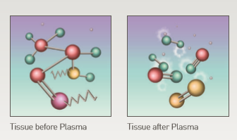 plasma.PNG